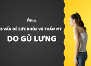 BẠN CÓ ĐANG GÙ LƯNG? 8 VẤN ĐỀ VỀ SỨC KHỎE VÀ THẨM MỸ DO GÙ LƯNG