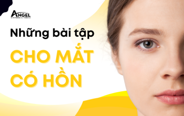 NHỮNG BÀI TẬP CHO MẮT CÓ HỒN, CẢI THIỆN MẮT KHÔNG ĐỀU, MẮT LỆCH, MẮT LÁC